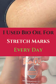 Bio Oil White Stretch Marks Before And After I Used Bio Oil For Stretch Marks Every Day Here Is What You Should Know Oil For Stretch Marks Stretch Marks Bio Oil