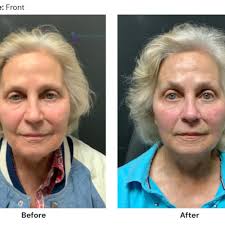 Top 10 Best Ent Doctor Near Palmdale, California