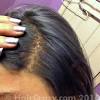 Treatments and cures for alopecia areata: Https Encrypted Tbn0 Gstatic Com Images Q Tbn And9gctsyscpr Ntfgg 1msrnc6 Dwavlzwslohqjo Hreqv0nhxougo Usqp Cau