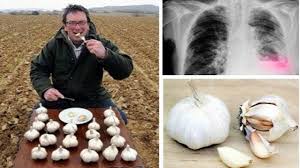 L'aglio è anche ottimo per coloro che soffrono di pressione alta. Quest Uomo Mangiava Aglio Tutti I Giorni E Questo E Quello Che E Successo Youtube