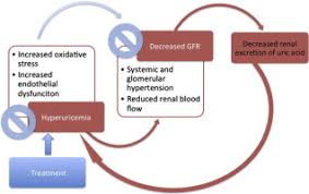 Image result for Hyperuricemia
