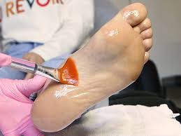 Maybe you would like to learn more about one of these? Chemical Foot Peel Removes Crusty Dead Skin And Callus Buildup