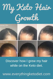 Keto Hair Growth Discover After I Loss Some How I Grew It Back Keto Hair Loss Keto Diet Ketones Diet