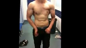 C'est une malformation congénitale qui touche aussi bien les garçons que les filles. Poland Syndrome Bodybuilding Motivation Syndrome De Poland Youtube