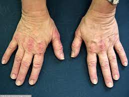 Maybe you would like to learn more about one of these? Medizin 3
