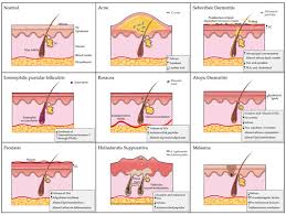 Image result for Dissotis glandulosa