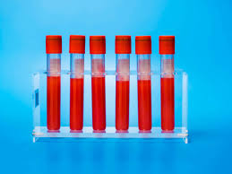 How Much Prenatal Genetic Information Do You Actually Want Wired