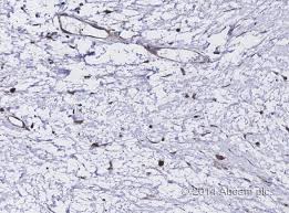 In the ammonium sulfate precipitation. Hrp Goat Anti Rabbit Igg Secondary Antibody Preadsorbed Ab7090 Abcam