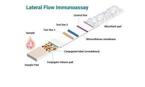 What is a covid lateral flow test? Two Successful Immunoassay Formats In Lateral Flow Devices