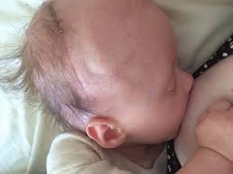You are unable to do everyday tasks such as looking at your phone, reading or getting out of bed. This Incredible Mom Breastfeeds Her Baby With Brain Cancer During Chemotherapy Kveller