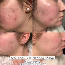 Debbie Pierce, Rodan+Fields Skincare