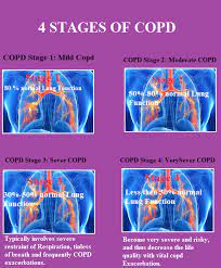Check spelling or type a new query. 4 Stages Of Copd Nursing Cheat Sheet Medical Estudy