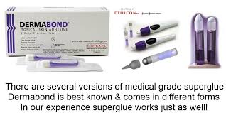 Can You Really Super Glue Wounds Closed Emergency Prepping Emergency Medical Medical Help