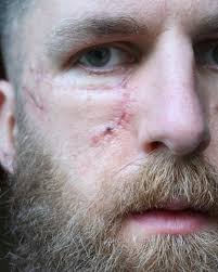 Be UV aware this summer