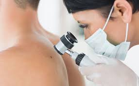 Le cancer de la peau est un cancer qui a connu une forte augmentation au cours des dernières années. Le 26 Mai 2017 Journee Nationale De Depistage Du Cancer De La Peau Blog Medical