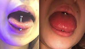 But if you're wondering how to clean your tongue without gagging, here's how! Tongue Piercing Swelling Causes Treatment Authoritytattoo