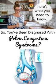 You Ve Been Diagnosed With Pelvic Congestion Syndrome What Now