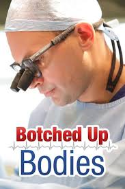 Botched Patients Botched Season Episode Full Episode Botched Dee's Bowling  Ball Full Episode Hotsell