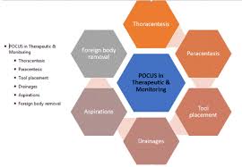 Diagnostic imaging at the point of care (poc) means clinicians are no longer required to move a patient from room to room, send a patient to another location for an ultrasound scan and can take an ultrasound machine into the field if necessary. Point Of Care Ultrasound Emerging Trend