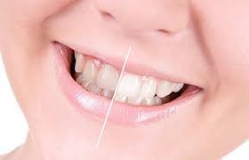 Merhaba, kadınlar kulübü'ne ücretsi̇z üye olarak yorumlar ile katkıda bulunabilir veya aklınıza takılan soruları sorabilirsiniz. Dis Beyazlatma Kadinlar Kulubu