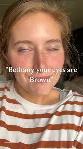 I Do Not Care How Rare My Eye Color Is