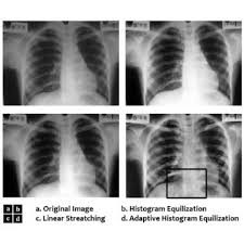 Pin On Contrast Radiography Test