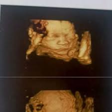 🤍Zin Myo San🤍 (@zinmyosan8)