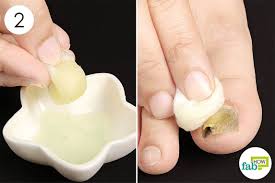 In this article, let me. How To Get Rid Of Toenail Fungus Fab How
