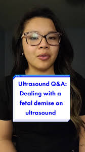 Replying to @mrski123 An urgent finding like a miscarriage can be a  difficult situation to navigate when we are not able to give results. It is  up to the Radiologist to make the call as to whether a ...