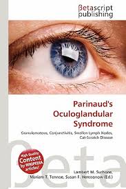 Parinaud S Oculoglandular Syndrome By Lambert M Surhone Mariam T Tennoe Susan F Henssonow 9786133157668 Reviews Description And More Betterworldbooks Com