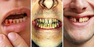 However, at some point, the stereotype started that british people have terrible teeth. What Teeth Problems Can Tell You About Your Health Dental Problems Can Be An Early Warning Sign For Chronic Conditions