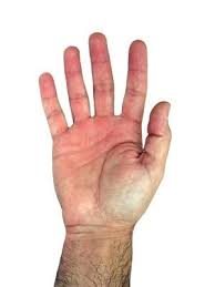 Pin On Crps
