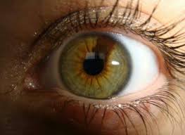 Sectoral Hetrochromia Ojos Verdes Ojos Bonitos Heterocromia