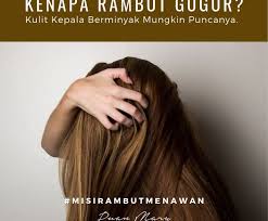 Penyelesaian untuk mengatasi rambut gugur. Punca Rambut Gugur Puan Mary