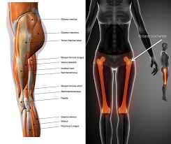 Image result for Snapping Hip