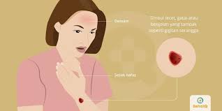 Penyakit pada mata memiliki penyebab yang beragam. Penyakit Akibat Hewan Selain Virus Corona Galeri Medika