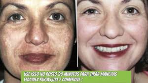 20 MINUTOS NO ROSTO PARA TIRAR MANCHAS,RUGAS E FLACIDEZ USE E COMPROVE!