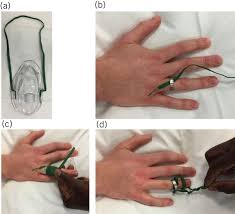 Image result for Ring Removal