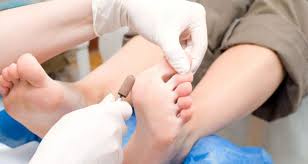 They are tall cylindrical protrusions of skin which if. Plantar Warts On Feet Mint Foot Care