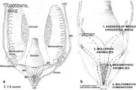 2 devi wold as, pham n, arici a. Diagnostic Imaging And Cataloguing Of Female Genital Malformations Insights Into Imaging Full Text