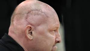 In second cancer fight, Beech Grove's Matt English brings his hard hat,  lunch pail