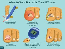 Alternatively, you may be suffering from toe nail fungus for sliding your feet and hit the shoe's side accidentally. When To Seek Treatment For Toenail Trauma