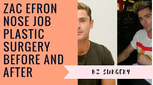 The musical, zac efron has sparked rumors of plastic surgery. Zac Efron Nose Job Plastic Surgery Before And After Youtube