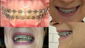 Gras, Joanne DO, 3779 Piedmont Ave, Oakland, CA 94611, US