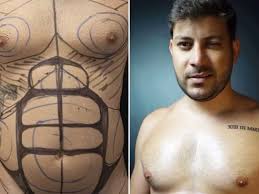 Ex-BBB Caio Afiune mostra resultado de lipo LAD e ginecomastia