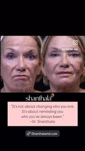 Shanthalamd Laser & Aesthetic Center