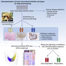 Molecular Portraits Of Early Rheumatoid Arthritis Identify Clinical And Treatment Response Phenotypes Sciencedirect