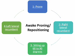 Maybe you would like to learn more about one of these? Cureus Awake Proning A Necessary Evil During The Covid 19 Pandemic