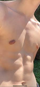 But how do you know if you have gynecomastia or just chest fat? I M Not Sure If I Have Gyno Or Just Stubborn Fat And I D Really Like To Know Others Info Because It S Really Throwing Off My Look And I Get Self Conscious About