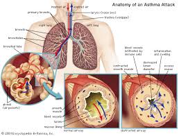 Respiratory Disease Definition Causes Major Types